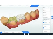 cerec-software-5x-220-x165px